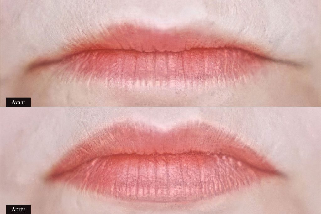 Avant/Après maquillage permanent lèvres